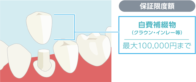 保証内容